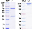 SDS-PAGE for Anti-DERP2 Antibody (SAA0629)