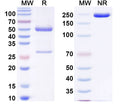 SDS-PAGE for Anti-DERP2 Antibody (SAA0631)