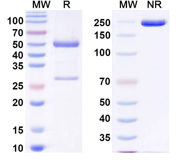 SDS-PAGE for Anti-DERP2 Antibody (SAA0632)
