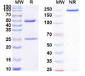 SDS-PAGE for Anti-DERP2 Antibody (SAA0635)