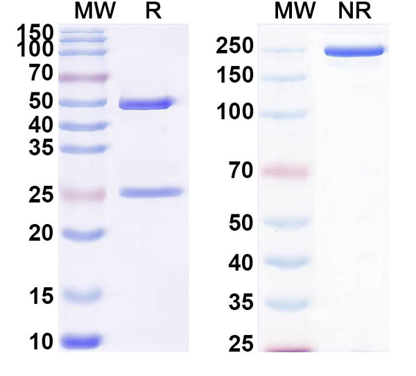 SDS-PAGE for Anti-DERP2 Antibody (SAA0635)
