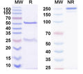 SDS-PAGE for Anti-DERP2 Antibody (SAA0636)