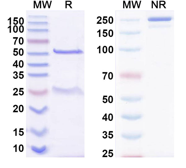 SDS-PAGE for Anti-DERP2 Antibody (SAA0636)
