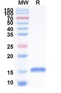 SDS-PAGE for Anti-Helicobacter pylori babA Nanobody (Nb-ER19).