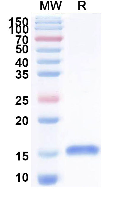 SDS-PAGE for Anti-Helicobacter pylori babA Nanobody (Nb-ER19).