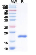 SDS-PAGE for Anti-Helicobacter pylori babA2 Nanobody (Nb-ER14).