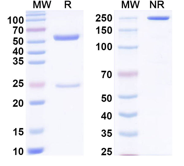 SDS-PAGE for Anti-Mycobacterium tuberculosis katG Antibody (SAA2165)