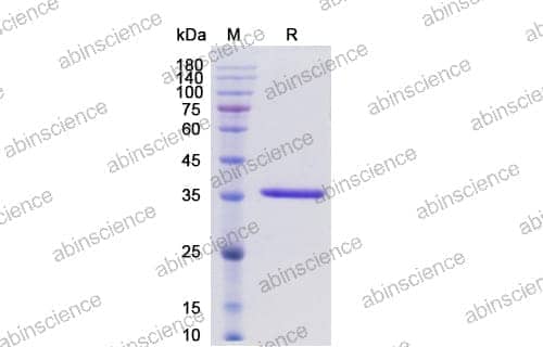 SDS-PAGE for IdeZ Protease (IgG Specific)