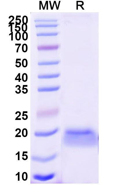 SDS-PAGE for Anti-dsRed Nanobody (SAA1152)