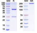 SDS-PAGE for Anti-Mycobacterium tuberculosis sodB Antibody (SAA2171)
