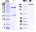SDS-PAGE for Anti-Helicobacter pylori trxA/Thioredoxin Monoclonal Antibody (1A174)