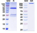 SDS-PAGE for Anti-LPS/Lipid A Antibody (SAA0579).