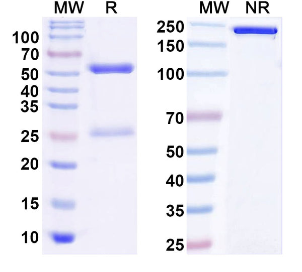 SDS-PAGE for Anti-Vibrio cholerae LPS/Lipopolysaccharide Antibody (SAA0582).