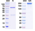 SDS-PAGE for Anti-LPS/Lipopolysaccharide Antibody (SAA0584).