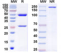 SDS-PAGE for Anti-Neisseria meningitidis?group B LPS/Lipopolysaccharide Antibody (SAA1462)