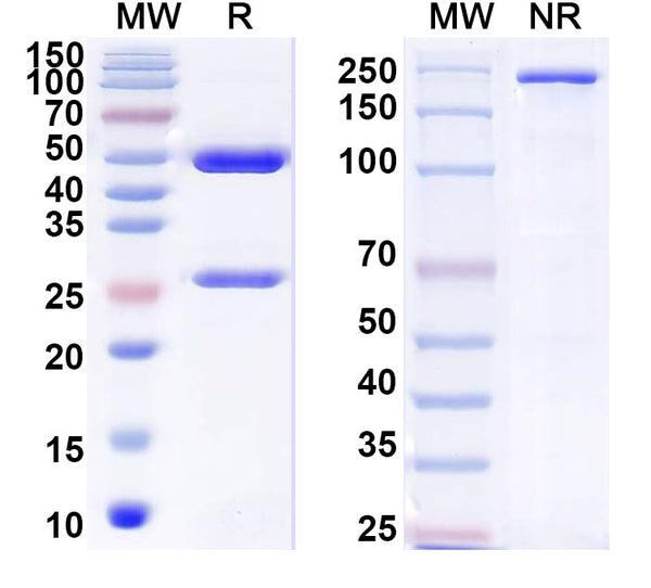 SDS-PAGE for Anti-Neisseria meningitidis?group B LPS/Lipopolysaccharide Antibody (SAA1462)