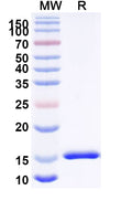 SDS-PAGE for Anti-Clostridioides difficile Toxin A/tcdA Nanobody (SAA0992)