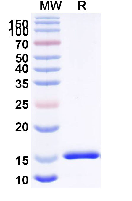 SDS-PAGE for Anti-Clostridioides difficile Toxin A/tcdA Nanobody (SAA0992)