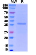 Recombinant Salmonella schwarzengrund murG Protein, C-His