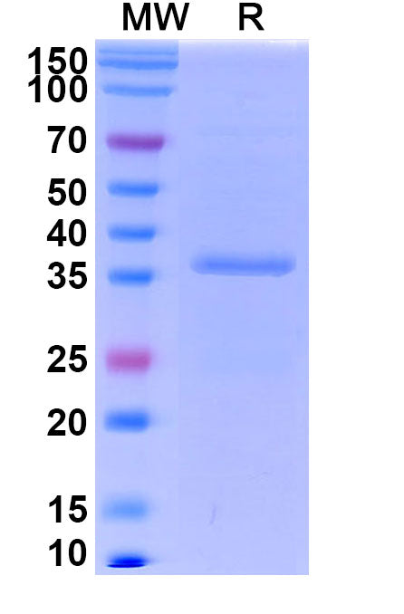 Recombinant Salmonella schwarzengrund murG Protein, C-His