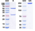 SDS-PAGE for Anti-Helicobacter pylori babA Antibody (SAA2271)
