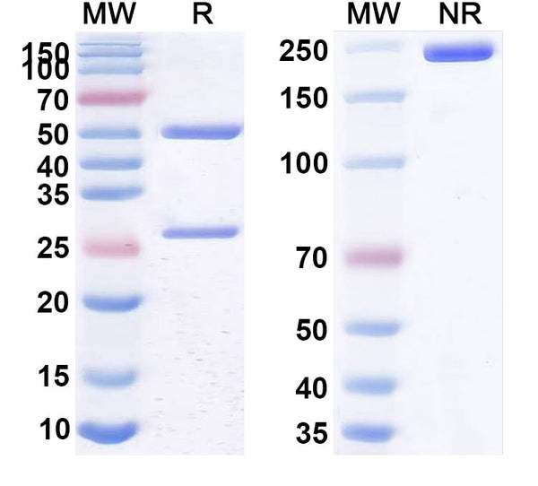 SDS-PAGE for Anti-Helicobacter pylori babA Antibody (SAA2271)
