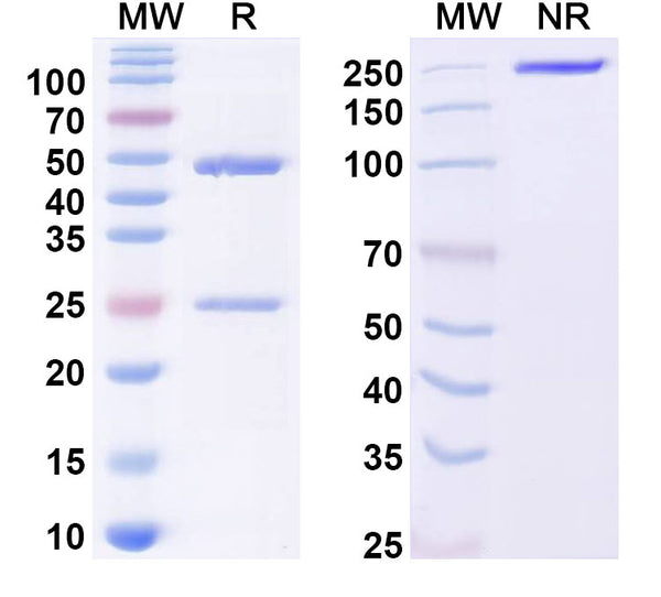 SDS-PAGE for Anti-Plasmodium vivax PVDR Antibody (SAA2302)