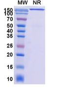 Anti-Escherichia coli shiga toxin type 2/stx2B Reference Antibody (Urtoxazumab) – Figure 1 of 1