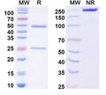 SDS-PAGE for Anti-Dermatophagoides pteronyssinus DERPI Antibody (10B9)
