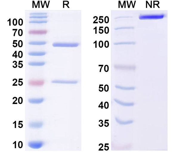 SDS-PAGE for Anti-Dermatophagoides pteronyssinus DERPI Antibody (10B9)