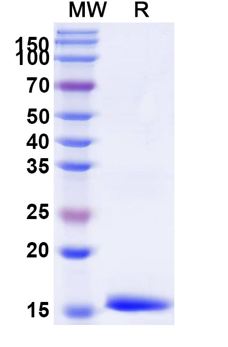 SDS-PAGE for Anti-Alternaria species Tenuazonic acid Nanobody (3A10)