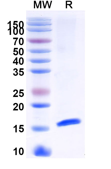 SDS-PAGE for Anti-Alternaria species Tenuazonic acid Nanobody (3B8)