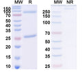 Anti-Endotoxin/LipidA Reference Antibody (Edobacomab) – Figure 1 of 1