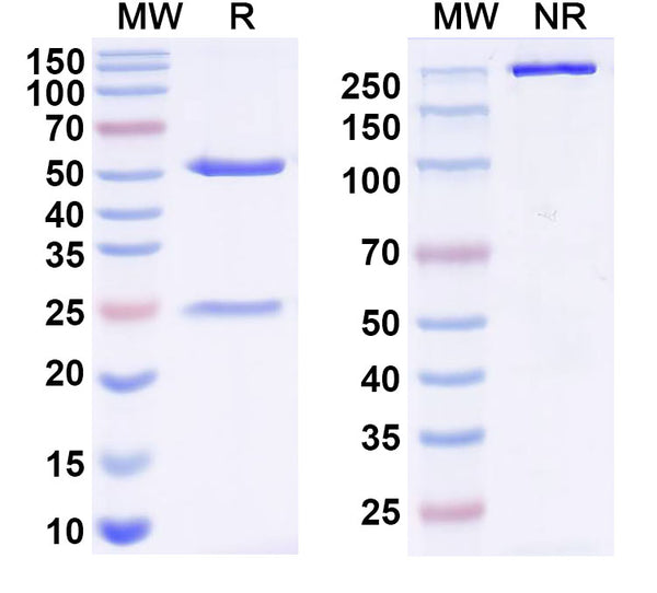 SDS-PAGE for Anti-Bacillus anthracis lef/LF/Lethal factor Antibody (F5-1)