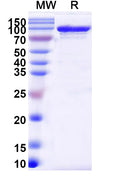 Endo S2/Endo-beta-N-acetylglucosaminidase