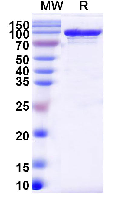 Endo S2/Endo-beta-N-acetylglucosaminidase
