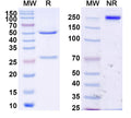 SDS-PAGE for Anti-Clostridium Difficile Toxin B/tcdB Monoclonal Antibody (1A252)