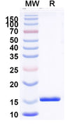 SDS-PAGE for Anti-Clostridioides difficile Toxin B/tcdB Nanobody (SAA1083)