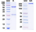 SDS-PAGE for Anti-Clostridium Difficile Toxin B/tcdB Monoclonal Antibody (1A254)