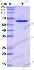 SDS-PAGE for Alpha-Fucosidase (AlfC)