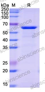 SDS-PAGE for Alpha-Fucosidase (AlfC)