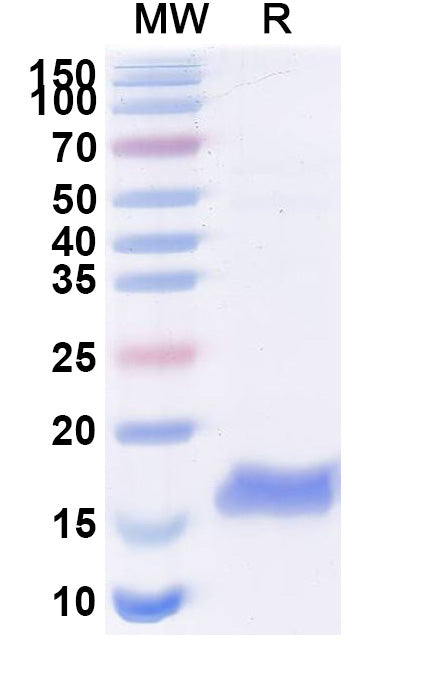 SDS-PAGE for Anti-Escherichia coli trxA/Thioredoxin Nanobody (SAA1139)