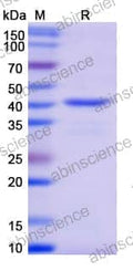 SDS-PAGE for Neuraminidase (Sialidase)