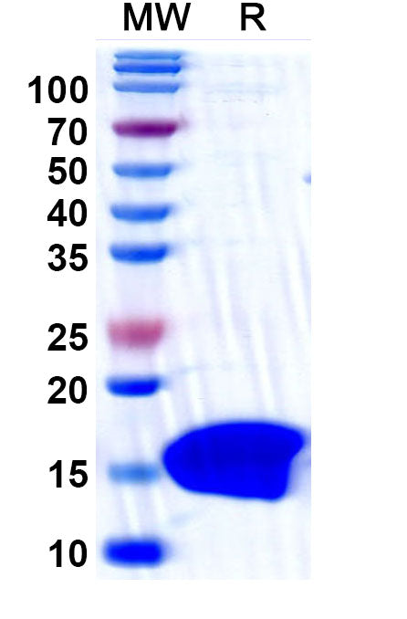 SDS-PAGE for Anti-Clostridium botulinum botA/BOTOX Nanobody (SAA1450)