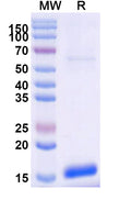 SDS-PAGE for Anti-Clostridium botulinum botA/BOTOX Nanobody (SAA0922).