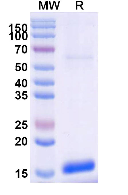SDS-PAGE for Anti-Clostridium botulinum botA/BOTOX Nanobody (SAA0922).