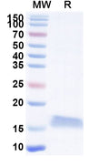 SDS-PAGE for Anti-Clostridium botulinum botA/BOTOX Nanobody (SAA0924)