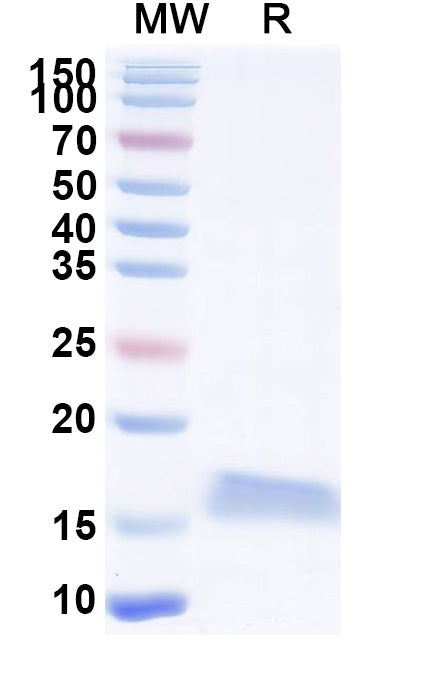 SDS-PAGE for Anti-Clostridium botulinum botA/BOTOX Nanobody (SAA0924)