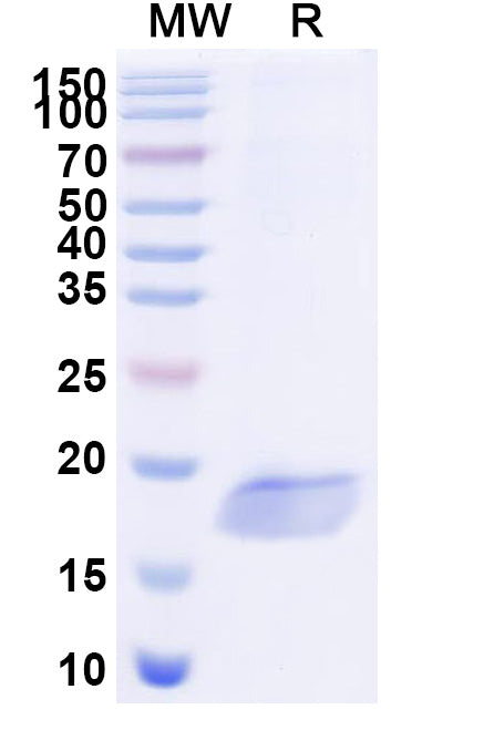 SDS-PAGE for Anti-Clostridium botulinum botA/BOTOX Nanobody (SAA0927)