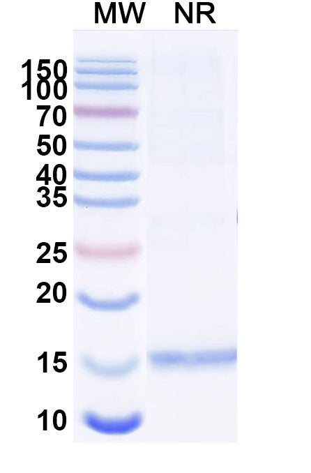SDS-PAGE for Anti-Clostridium botulinum botA/BOTOX Nanobody (SAA0928)